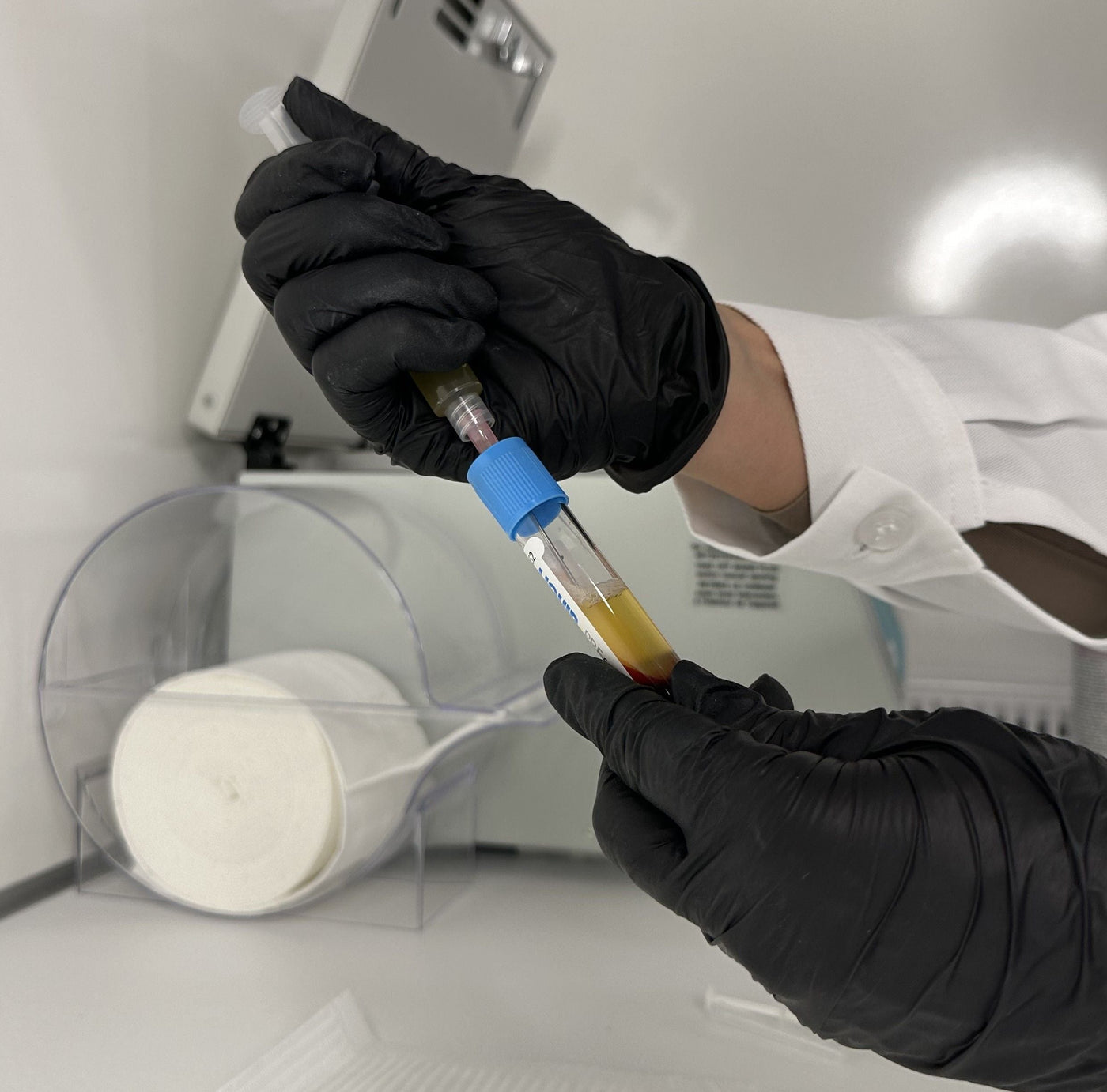 Exosomes vs Polynucleotides vs PRP: Which Regenerative Treatment, When?