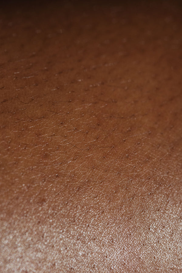 Skin Boosters vs Dermal Fillers: Choosing the Right Tool for the Job