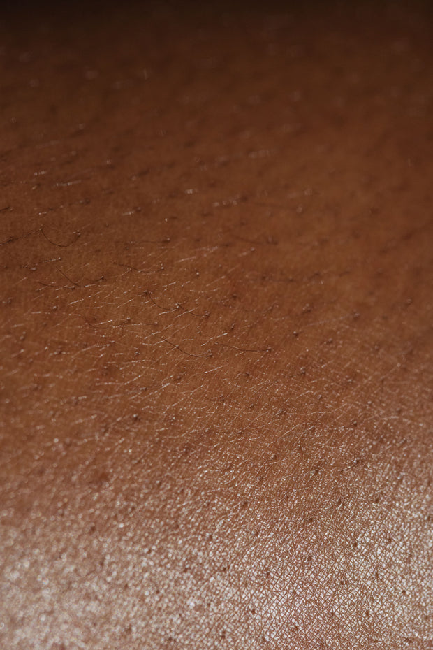 Skin Boosters vs Dermal Fillers: Choosing the Right Tool for the Job