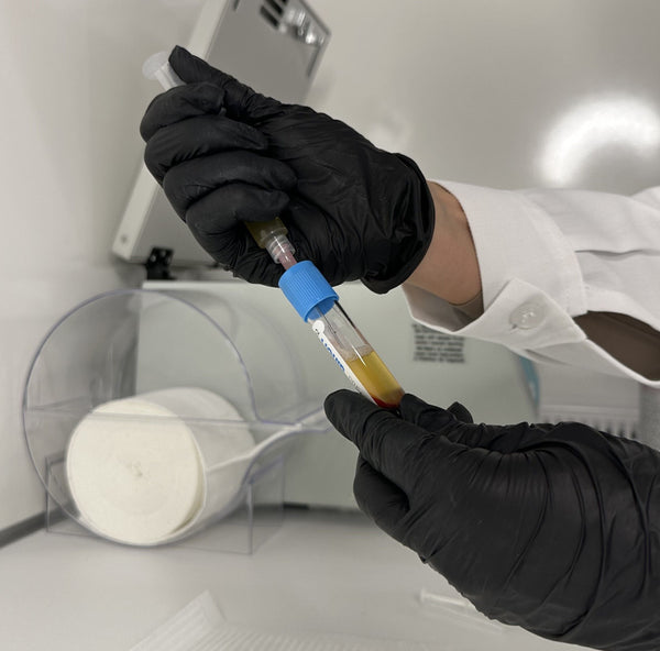 Exosomes vs Polynucleotides vs PRP: Which Regenerative Treatment, When?