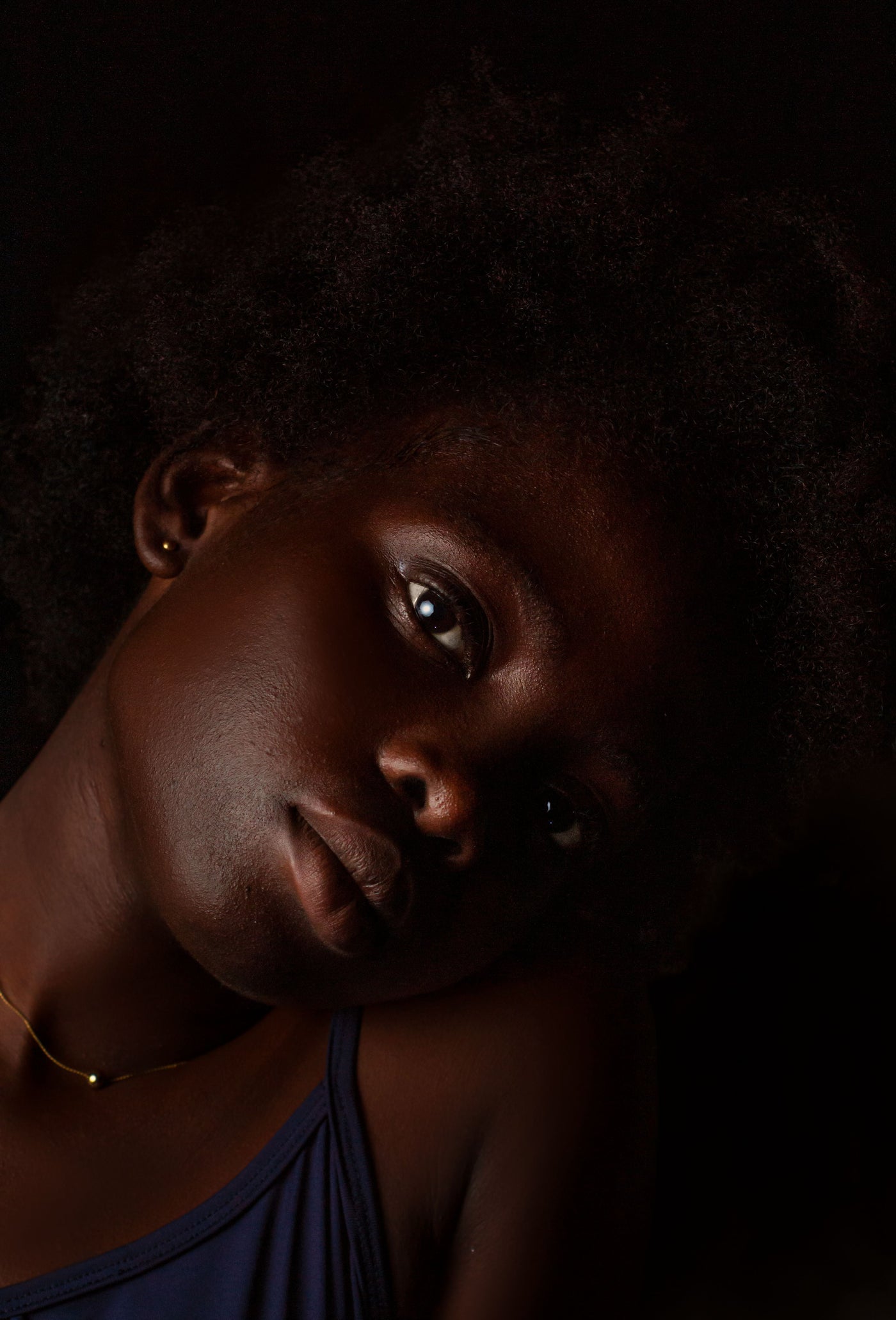 Treating Skin of Colour: Safe and Effective Protocols Across Fitzpatrick Types