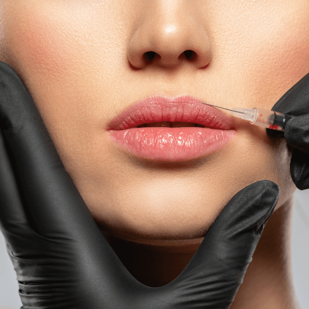 Close-up of lip filler injection by professional in black gloves – lip enhancement treatment