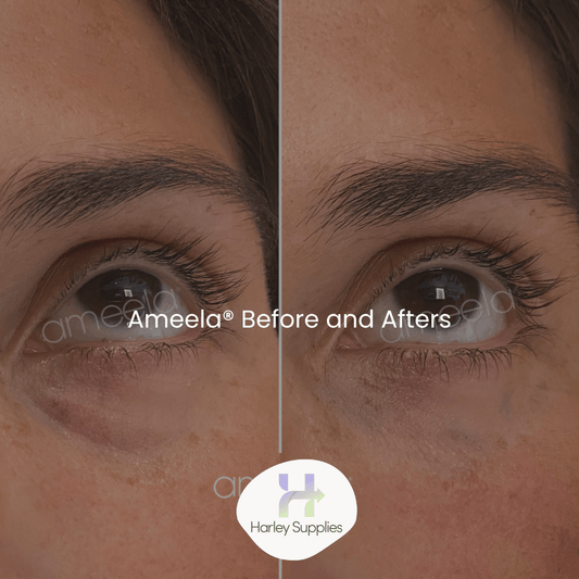 Ameela® Before & Afters– Free Digital Download